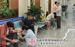 红皮型银屑病会损害脏腑吗 科学认知做好全状态守护