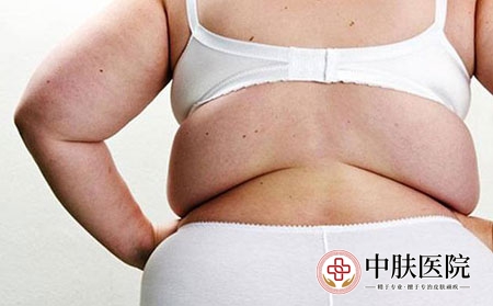 2 (154)肥胖