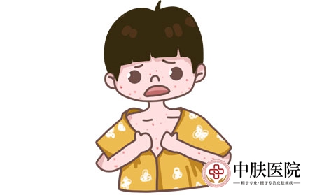摄图网_401360863_过敏（企业商用）
