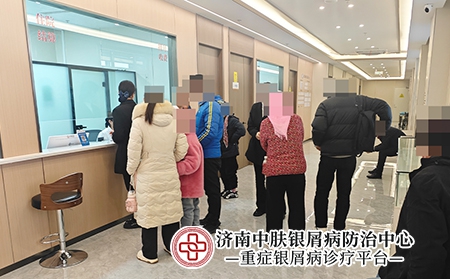 济南治疗银屑病医院排名榜-济南中肤银屑病医院