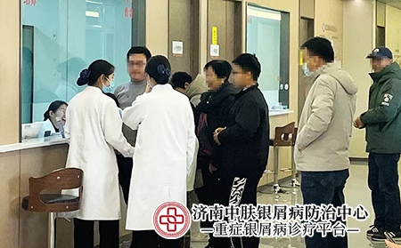 济南市银屑病医院排名-济南中肤银屑病医院