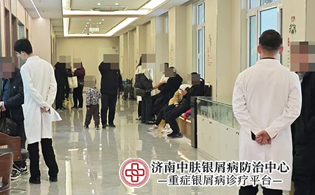 济南十大银屑病医院-济南中肤银屑病医院
