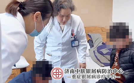 济南哪个医院看银屑病-济南中肤银屑病医院