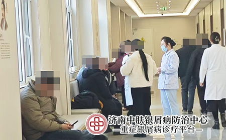 济南看银屑病的医院-济南中肤银屑病医院 济南看银屑病的医院-济南中肤银屑病医院