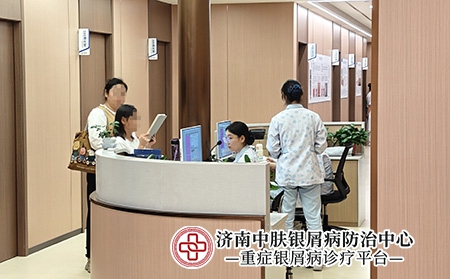 济南牛皮癣皮肤镜检查-济南中肤医院