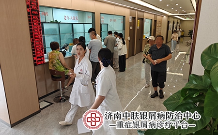济南牛皮癣治疗专家-济南中肤医院