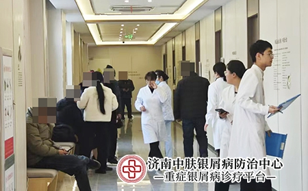 济南哪里治疗银屑病-济南中肤银屑病医院 济南哪里治疗银屑病-济南中肤银屑病医院