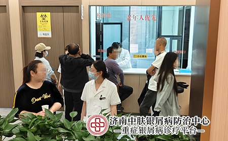 济南银屑病专科医院-济南中肤医院 济南银屑病专科医院-济南中肤医院